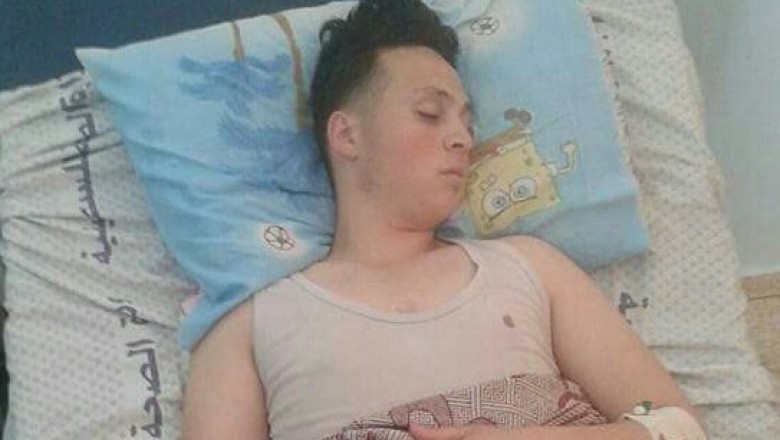 إصابة الشاب محمد توبه حسن البطه 