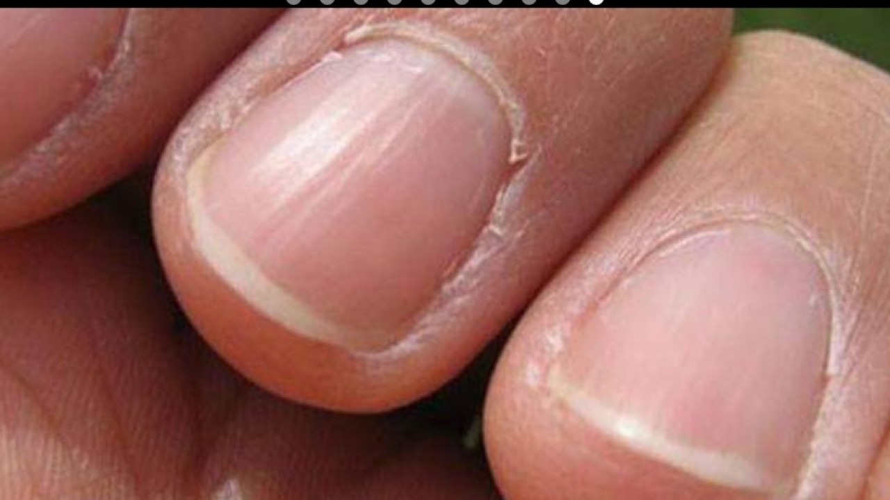 إذا شعرت بهذه الأعراض فأنت مصاب بهذا المرض الخطير